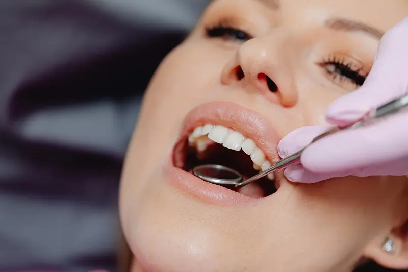 La Periodontitis