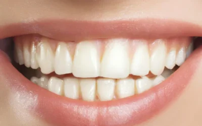 La Periodontitis: identifica y evita esta amenaza en tus encías