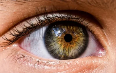 Uveítis o Inflamación de la Úvea: Una Amenaza para la Visión