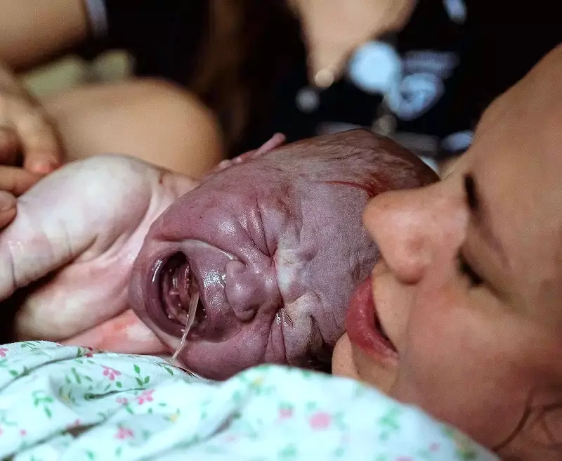 Síndrome de Aspiración Meconial