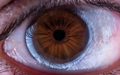 Glaucoma y salud ocular: el impacto de la presión intraocular en la visión