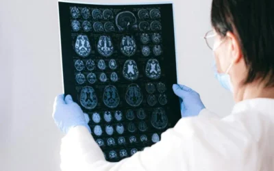 Salud Cerebral: claves para prevenir el deterioro y el alzhéimer