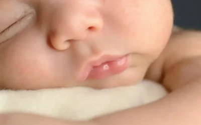 Melanocitosis dérmica: por qué aparecen manchas azules en los recién nacidos